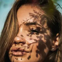 ilustrasi cara menghilangkan kulit belang karena sinar matahari/ Aleksandar Pasaric/pexels