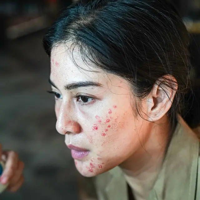 Demi Film Ini 7 Potret Dian Sastro Tampil Jerawatan yang Curi Perhatian