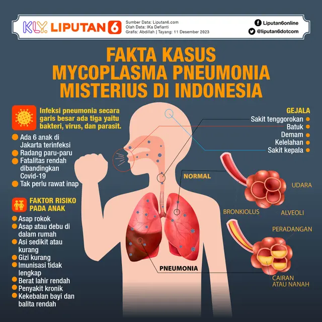 INFOGRAFIS JOURNAL_ Fakta Kasus Mycoplasma Pneumonia Misterius di Indonesia
