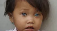 Amelia Anggraeni, bocah 2,5 tahun prmilik bola mata yang bisa berubah warna putih, coklat, abu-abu dan biru. (Liputan6.com/Huyogo Simbolon)
