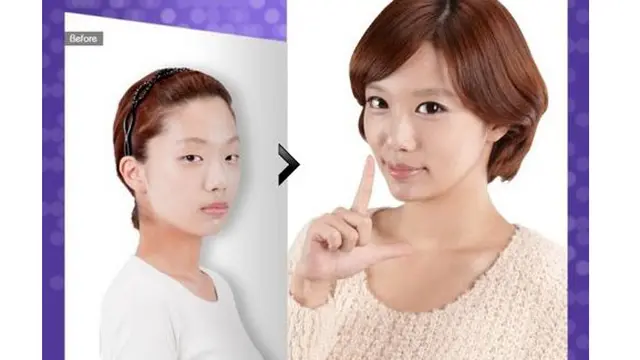 (c) kpsurgery tumblr.com