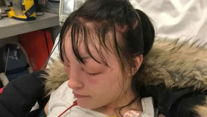 [Bintang] Warnain Rambut Sendiri di Rumah, Wajah Wanita Ini Langsung Bengkak