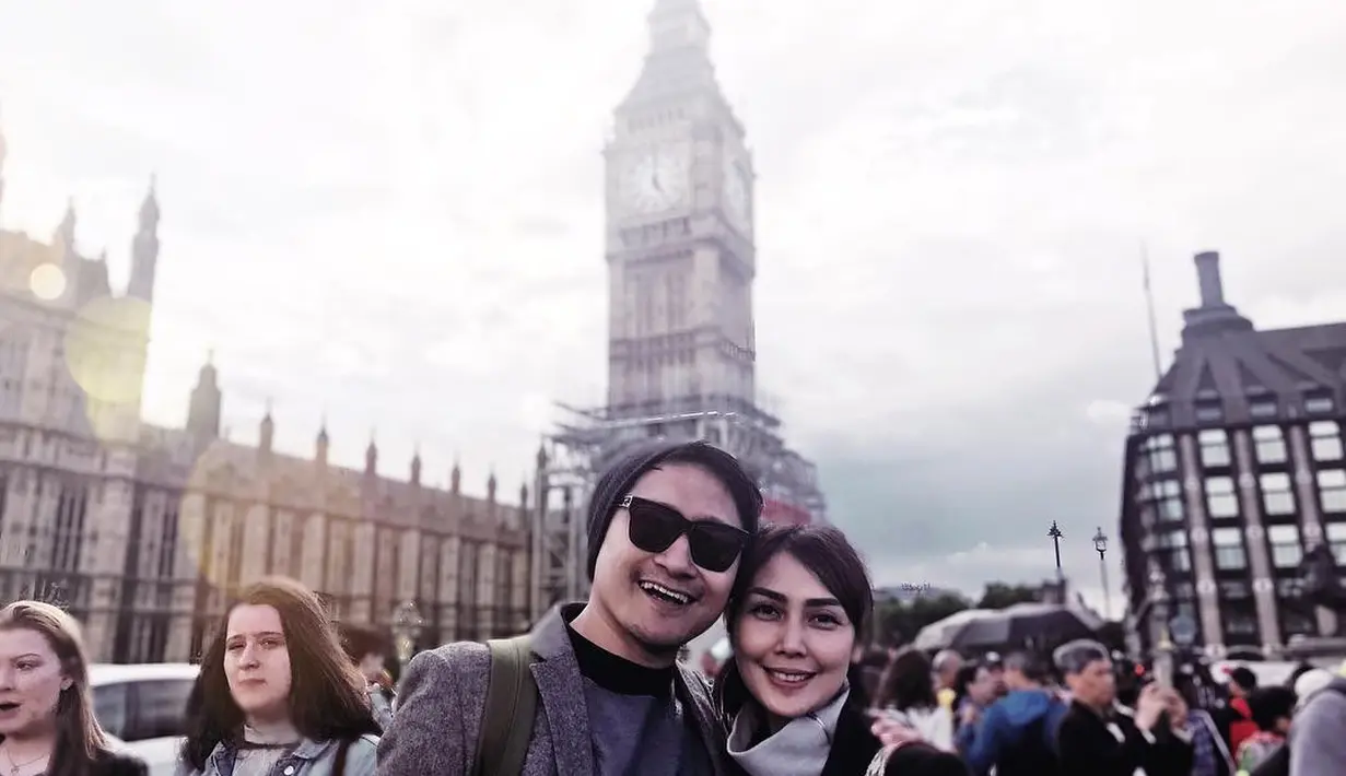 "Mau kondangan makanya makeup. Akhirnya ditahan-tahanlah. Awalnya panas gini doang, lama-lama kulitnya mulai ngelupas, melepuh gitu, akhirnya dilarikan ke RS," jelas sang manajer. (Instagram/ariekuntung)