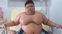 Kondisi Rizki, bocah obesitas asal Palembang itu kini dibantu mesin ventilator. (Liputan6.com/Nefri Inge)