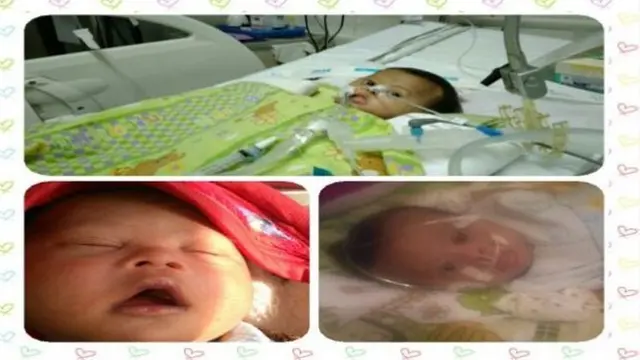 [Bintang] Derita Down Syndrome dan Infeksi Paru-paru, Bayi Berusia 8 Bulan Ini Memohon Bantuan