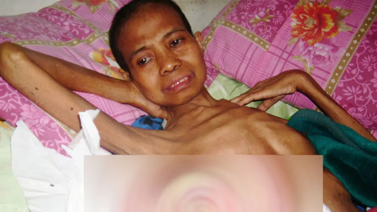 05102014-tumor.jpg