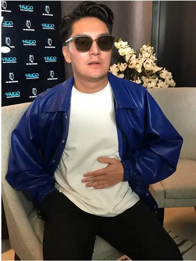 6 Potret Boy William Usai Oplas Hidung di Korea, Telan Biaya Rp1,1 Miliar