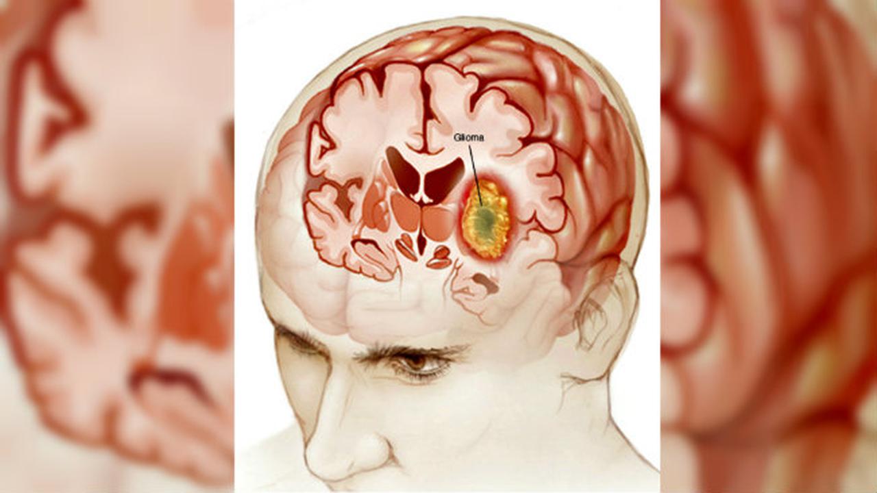 Harapan Miliki Keturunan Pada Bocah Tumor Otak 