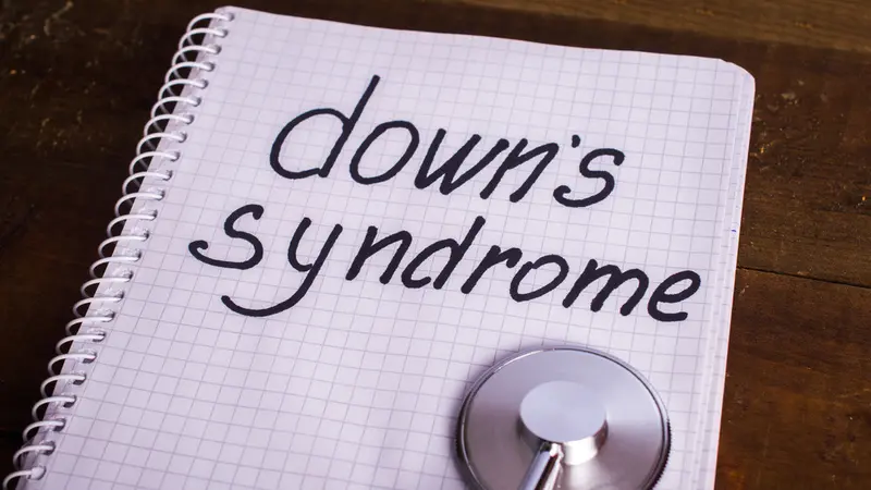 6 Masalah Kesehatan yang Menimpa Anak Down Syndrome (MsMaria/Shutterstock)