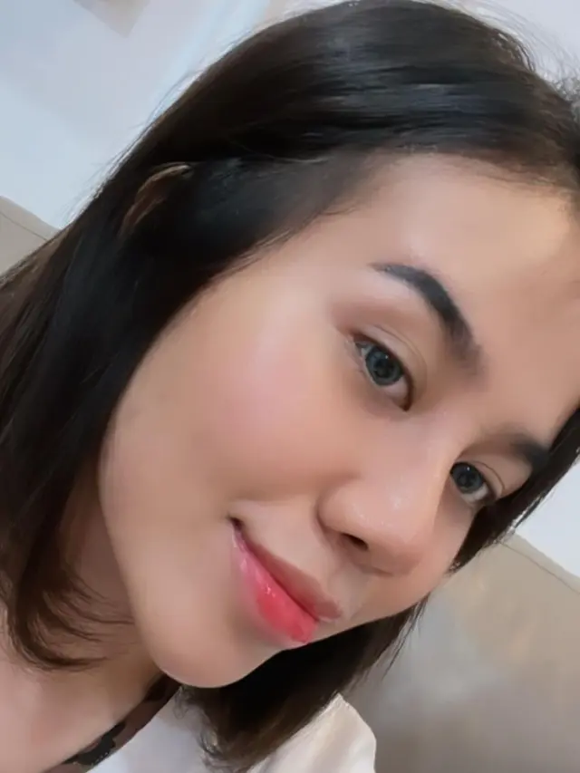 Potret Mayang Lucyana Lepas Perban Usai Operasi Plastik di Bagian Hidung