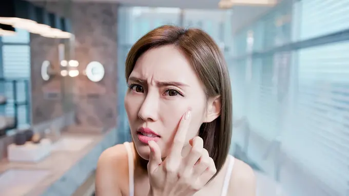 Kulit Kering Ternyata Bisa Jerawatan, Ini Lho Penyebabnya!