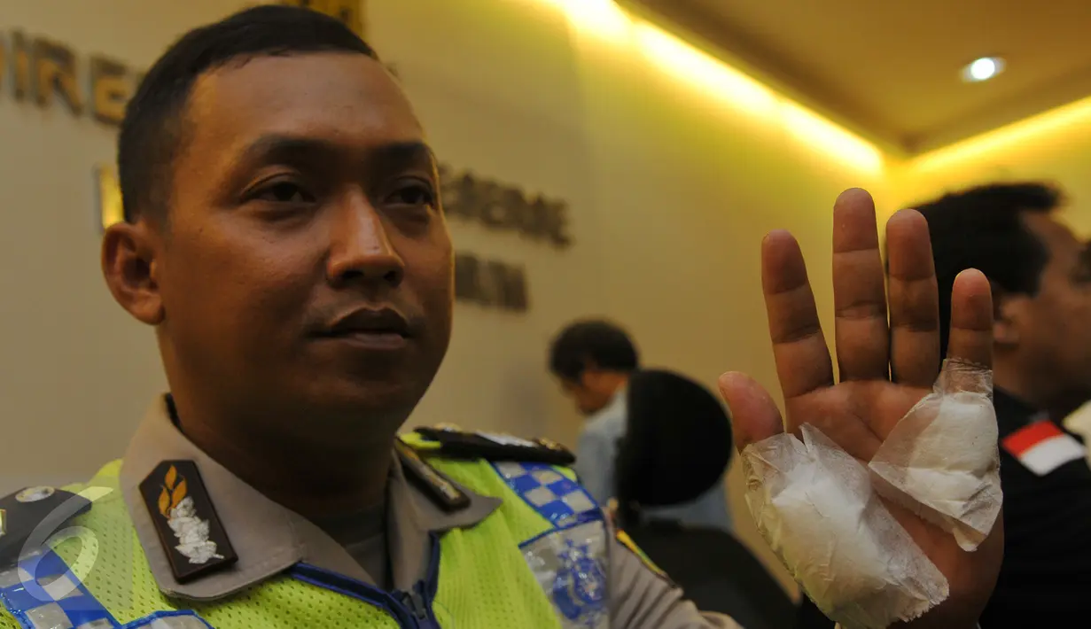 Seorang anggota Polantas memperlihatkan luka akibat ditabrak oleh Daniel Cesar, Jakarta, Kamis (1/10/2015). Supir taksi yang bernama Daniel Cesar kini diamankan Polisi. (Liputan6.com/Faisal R Syam)