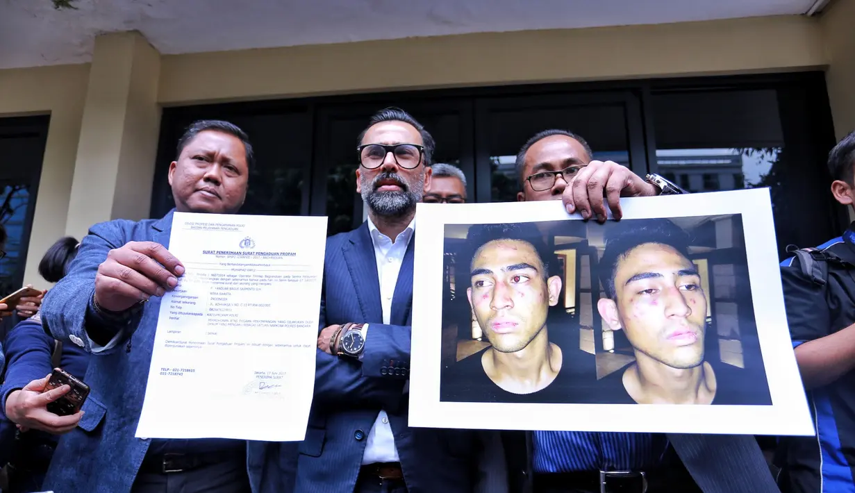 "Dan kembali orang Jatanras juga menemukan kesulitan terhadap security hotel tersebut karena terkesan ditutupin dan akhirnya kami memutuskan langsung ke atas," ucap Jeremy. (Adrian Putra/Bintang.com)
