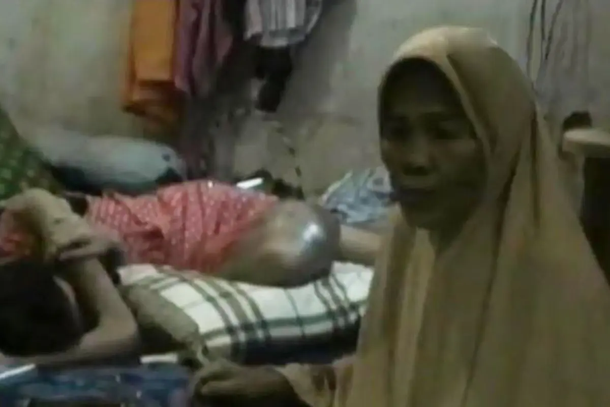 VIDEO: Terbentur Meja, Kaki Siswi SD Ini Terancam Diamputasi