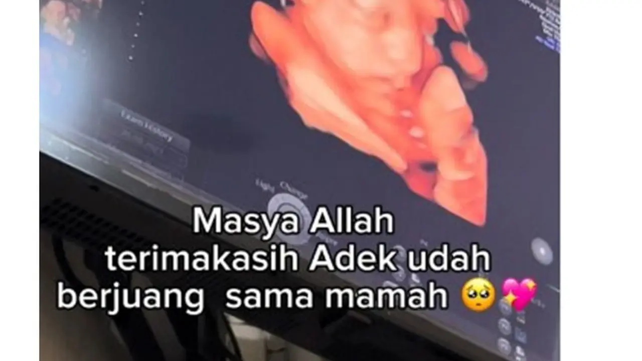 Dirahasiakan 8 Bulan, Ini 8 Potret Tasyi Athasyia Umumkan Hamil Anak Ke-4