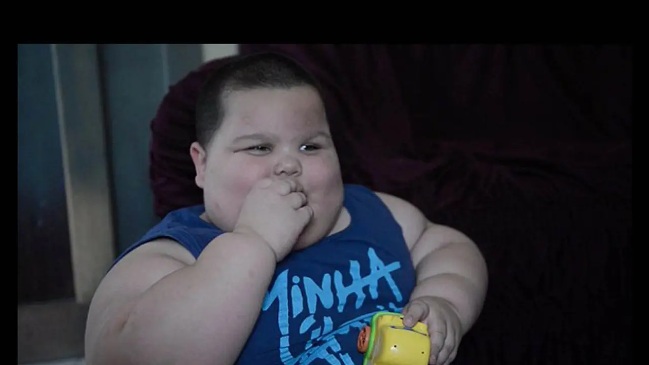 Tak Bisa Berhenti Makan, Bocah Tiga Tahun Ini Berbobot 70 Kg 