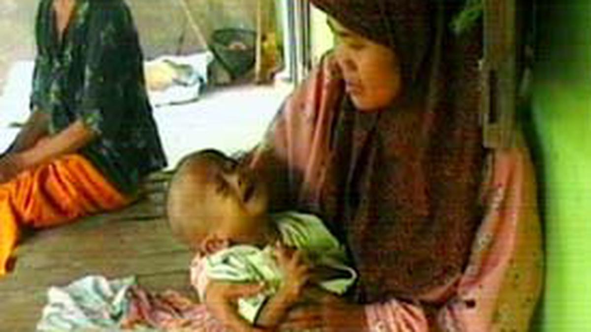 Ratusan Balita Di Klaten Menderita Gizi Buruk News Liputan6