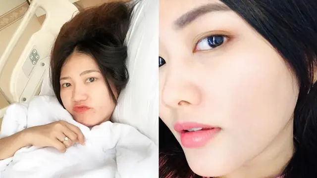 5 Beda Gaya Via Vallen dan Mella Rossa Tanpa Makeup, Makin Memesona