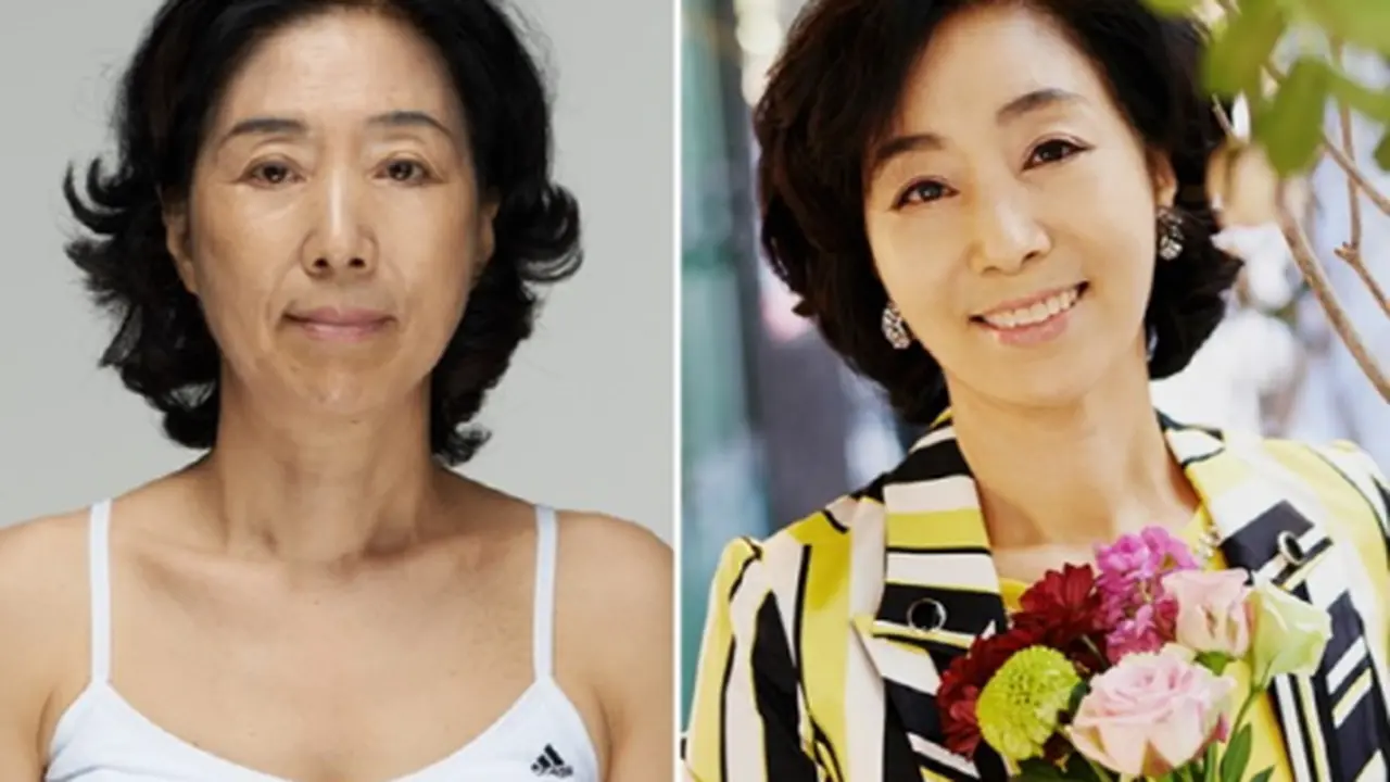 Korean Plastic Surgery