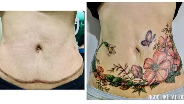 7 Potret Tato Keren Sulap Bekas Luka Jadi Seni Indah