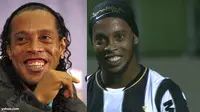 Ronaldinho Operasi Gigi