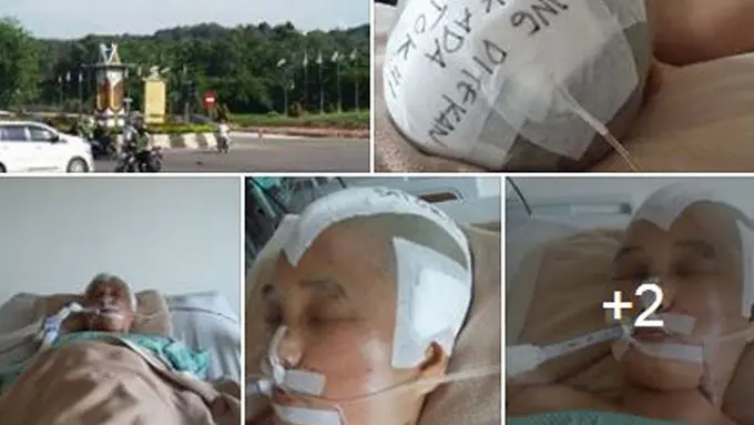 Wanita Pecah Tempurung Kepala Diduga Korban Tabrak Lari Polisi