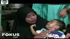Orang tua balita penderita gizi buruk sebagian besar tinggal di pemukiman padat dan lingkungan yang kurang sehat.