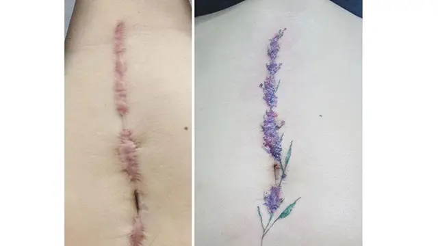 Wanita Ini Kreasikan Bekas Luka dengan Tato, 7 Hasilnya Mengagumkan