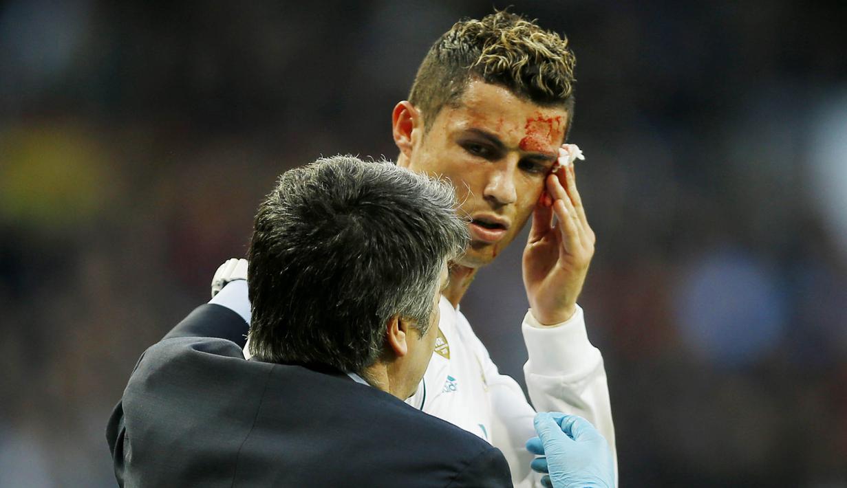 Striker Real Madrid, Cristiano Ronaldo, mengalami pendarahan di bagian pelipis saat melawan Deportivo La Coruna pada laga La Liga di Stadion Santiago Bernabeu, Minggu (21/1/2018). Real Madrid menang 7-1 atas Deportivo La Coruna. (AP/Francisco Seco)