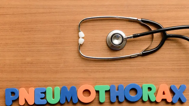 Ilustrasi pneumothorax