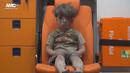 Omran Daqneesh, salah satu bocah yang berhasil diselamatkan dari reruntuhan gedung di Aleppo, Suriah (17/8). Omran selamat dari reruntuhan gedung akibat serangan jet tempur milik pemerintah Suriah. (REUTERS)