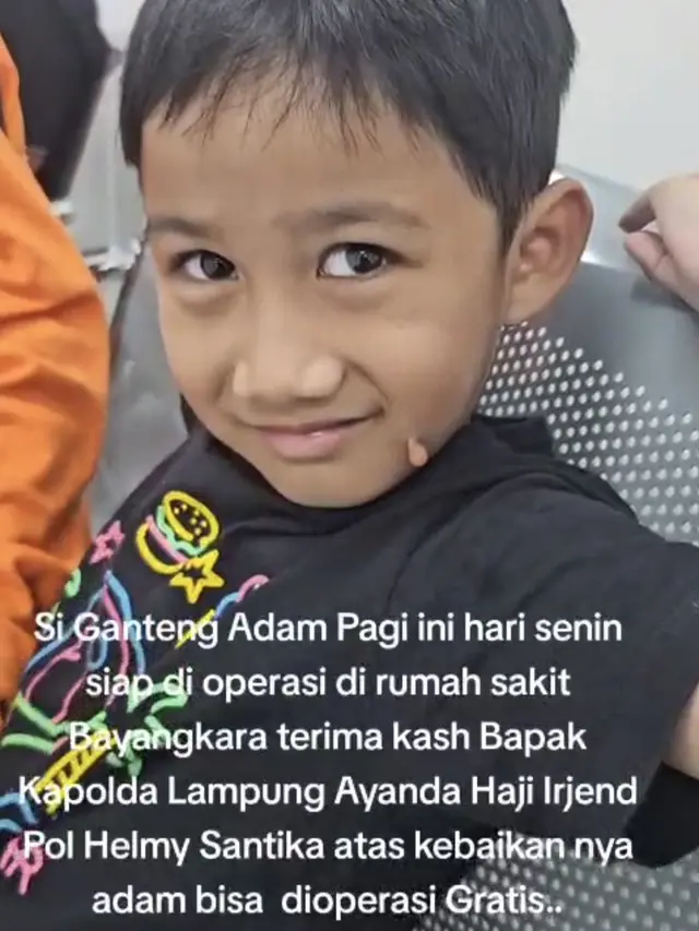 Adam, 9 tahun mendapat pelayanan kesehatan berupa operasi gratis dari Kapolda Lampung, Irjen Pol Helmy Santika. Foto : (Istimewa).