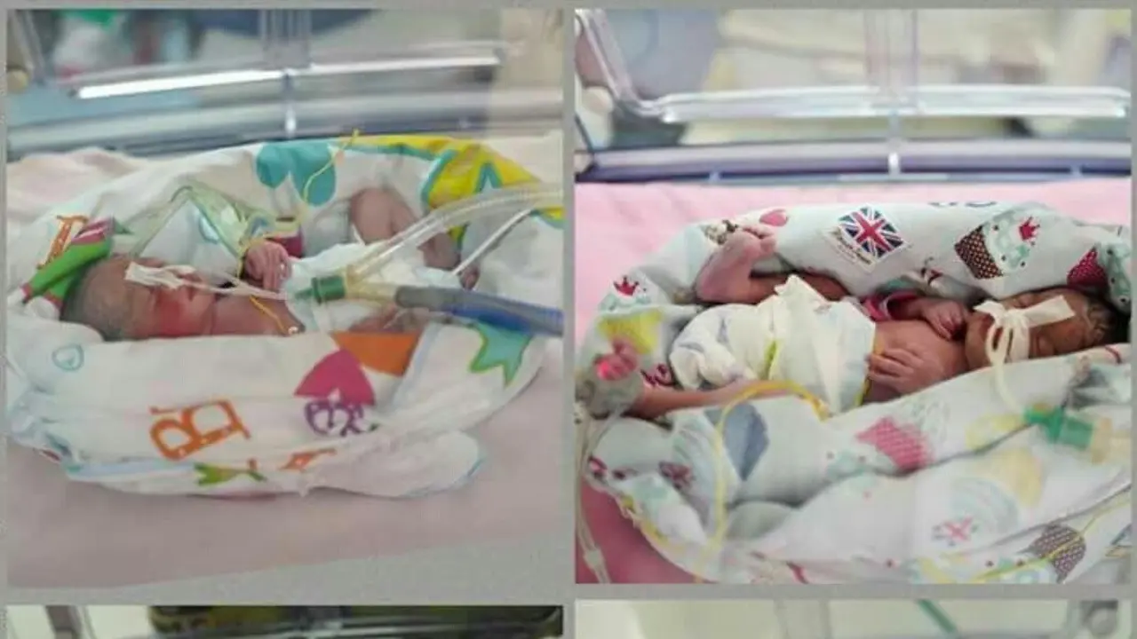 Pasien RSMH Palembang Lahirkan Bayi Kembar Empat