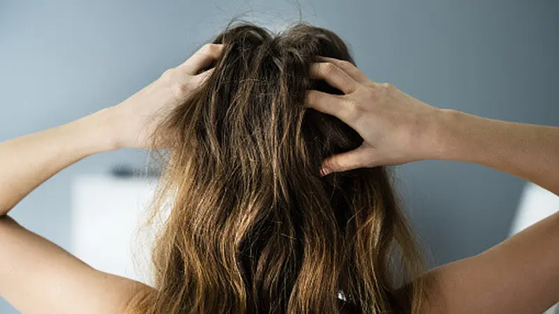 10 Cara Mudah Membasmi Kutu Rambut dengan Bahan Alami, Wajib Dicoba