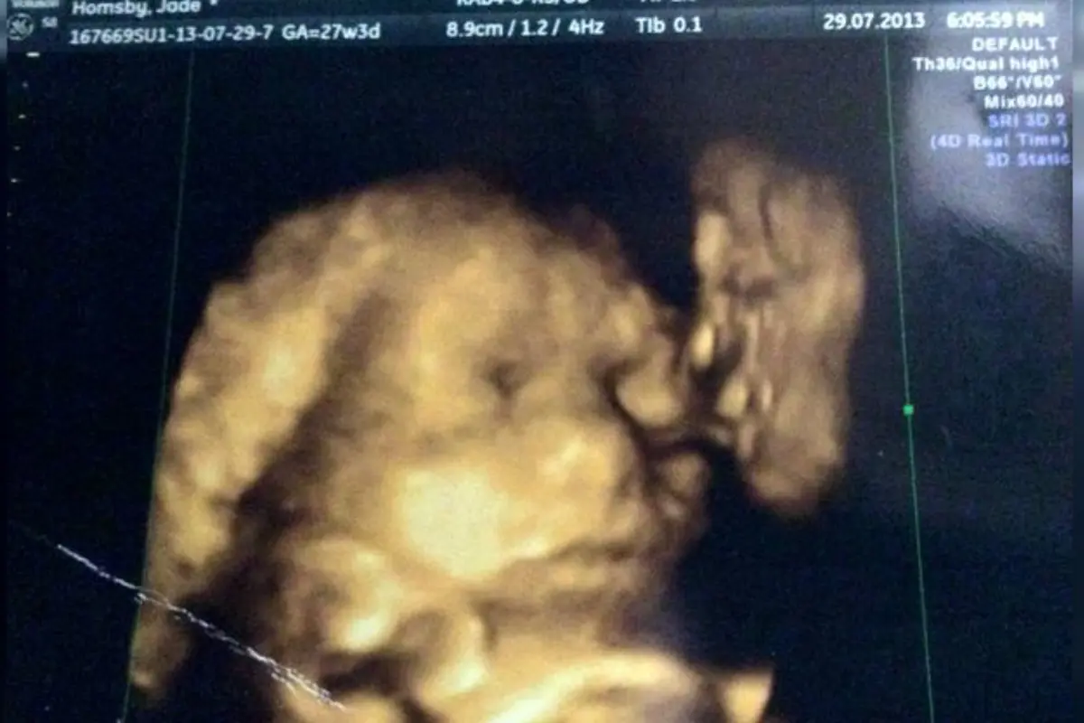 Penampakan Wajah Misterius Muncul di Hasil USG Bayi Ini