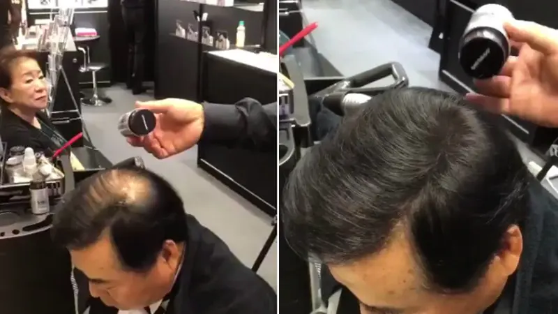 Solusi Kebotakan, Alat Ini Tumbuhkan Rambut dalam Sekejap