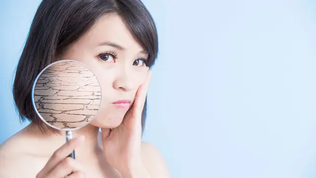 Kulit Kering Ternyata Bisa Jerawatan, Ini Lho Penyebabnya!