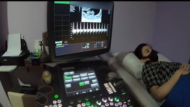 Bayinya Sehat, Ini 6 Momen Chelsea Olivia Periksa Kandungan