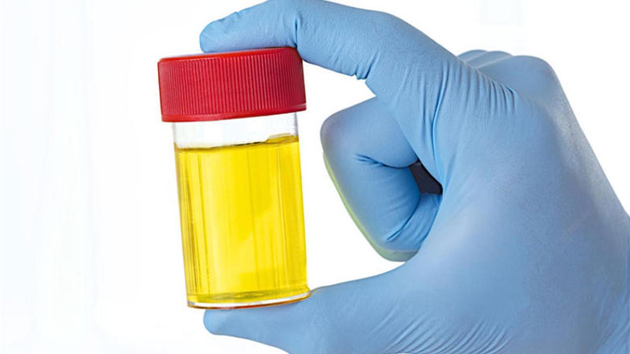 Urine Orang Sehat Juga Ada Bakterinya