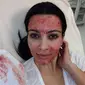 Kim Kardashian coba vampire facial. (dok. Instagram @kimkardashian)