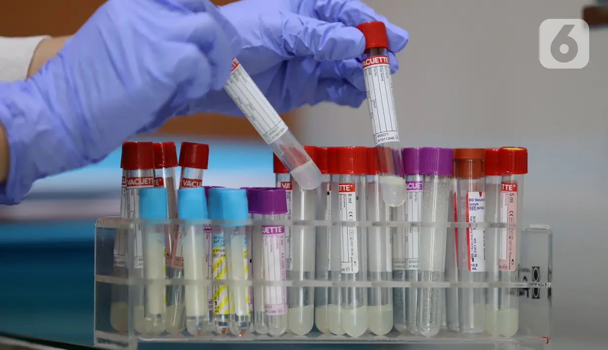 Peneliti mengambil sampel di Laboratorium Pusat Prodia di Jakarta, Rabu (3/6/2020). Prodia Wellness Genomics mampu mendeteksi risiko 39  jenis penyakit pada wanita dan 36 penyakit pada pria sekaligus. (Liputan6.com/HO/Deny)