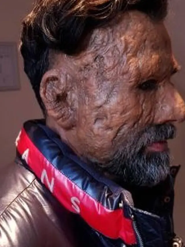 Jeremy Thomas menggunakan prostetik demi totalitas peran memiliki wajah penuh luka bakar di film Mengejar Surga (https://www.instagram.com/p/Cdw4mXeJw_j/)