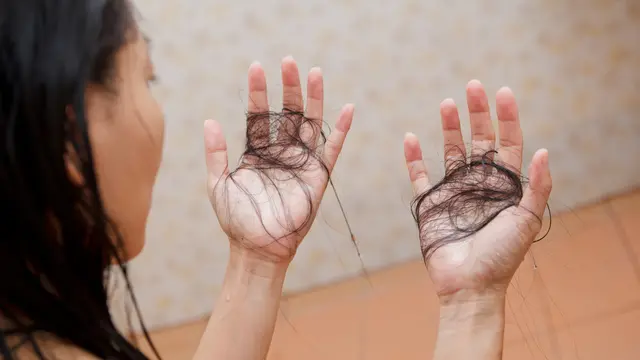 Rambut Rontok.