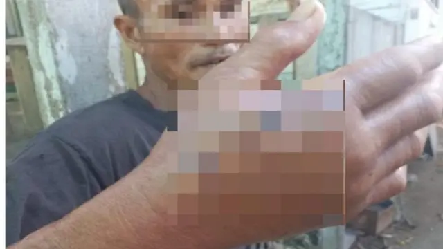 Pria Digigit Buaya