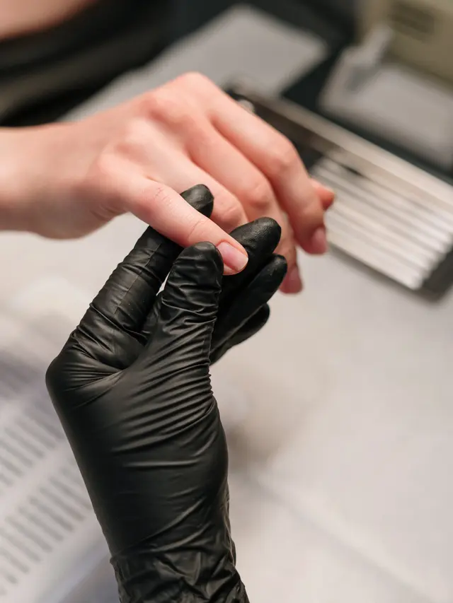 Tips Mencegah Kuku Paronikia