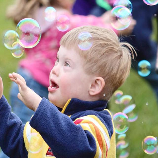 Anak Dengan Down Syndrome Itu Anugerah Health Liputan6 Com