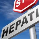 Begini Cara Mencegah Hepatitis A, B, dan C