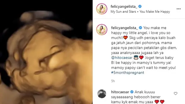 Felicya Angelista - Immanuel Caesar Hito (Foto: Instagram/@felicyangelista_)