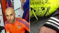 Bek Valencia mengupload foto luka di kakinya, usai diinjak oleh Luis Suarez (Daily Mail)