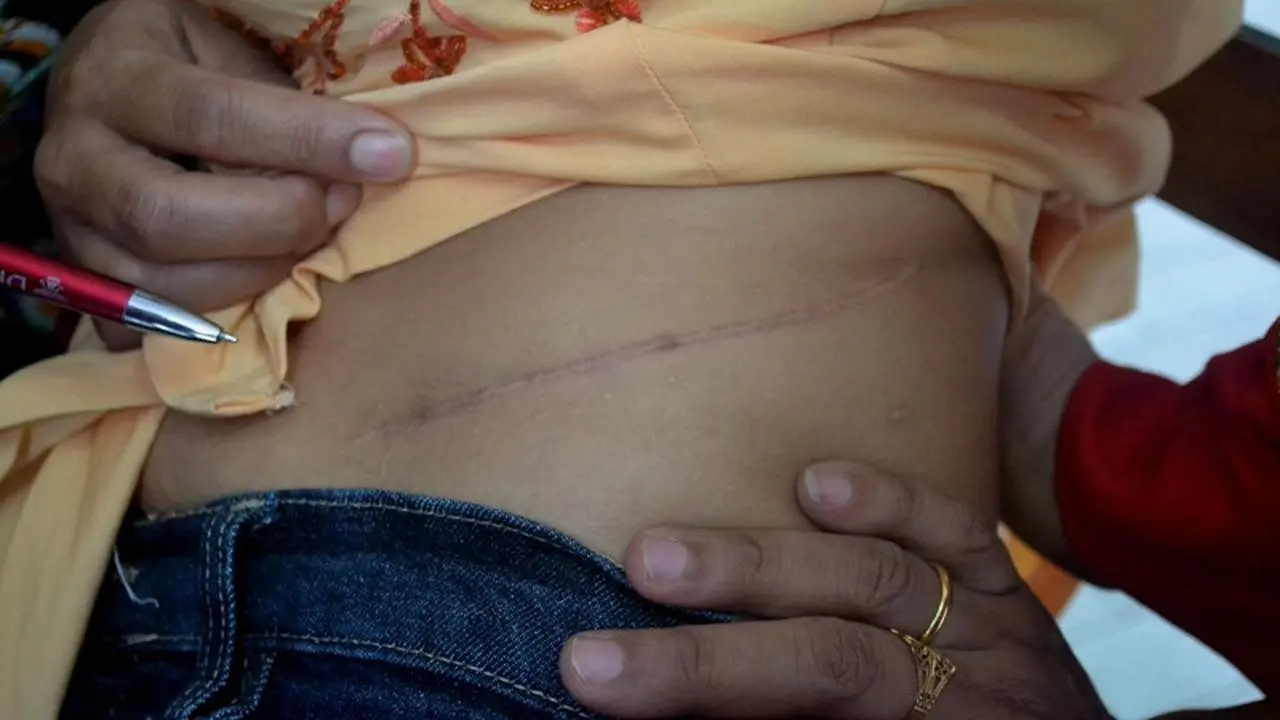 [Bintang] Demi Bayar Utang, Seorang Ibu di Malang Rela Menjual Ginjalnya